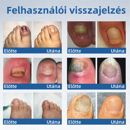 𝑯𝒆𝒂𝒍𝒓𝒊𝒛𝒆® 𝑵𝒂𝒏𝒐 𝑮𝒚𝒐𝒓𝒔 𝑯𝒂𝒕á𝒔ú 𝑻𝒊𝒔𝒛𝒕í𝒕ó 𝑲ö𝒓ö𝒎𝒈𝒐𝒎𝒃𝒂 𝑬𝒍𝒍𝒆𝒏𝒊 𝑱𝒂𝒗í𝒕ó 𝑭𝒐𝒍𝒚𝒂𝒅é𝒌 🧑‍⚕️ | 𝑯𝒂𝒕é𝒌𝒐𝒏𝒚 7 𝒏𝒂𝒑 𝒂𝒍𝒂𝒕𝒕, 𝒕𝒂𝒓𝒕ó𝒔𝒂𝒏 𝒎𝒆𝒈𝒔𝒛ü𝒏𝒕𝒆𝒕𝒊 𝒂 𝒌𝒊𝒗á𝒍𝒕ó 𝒐𝒌𝒐𝒕 🥥