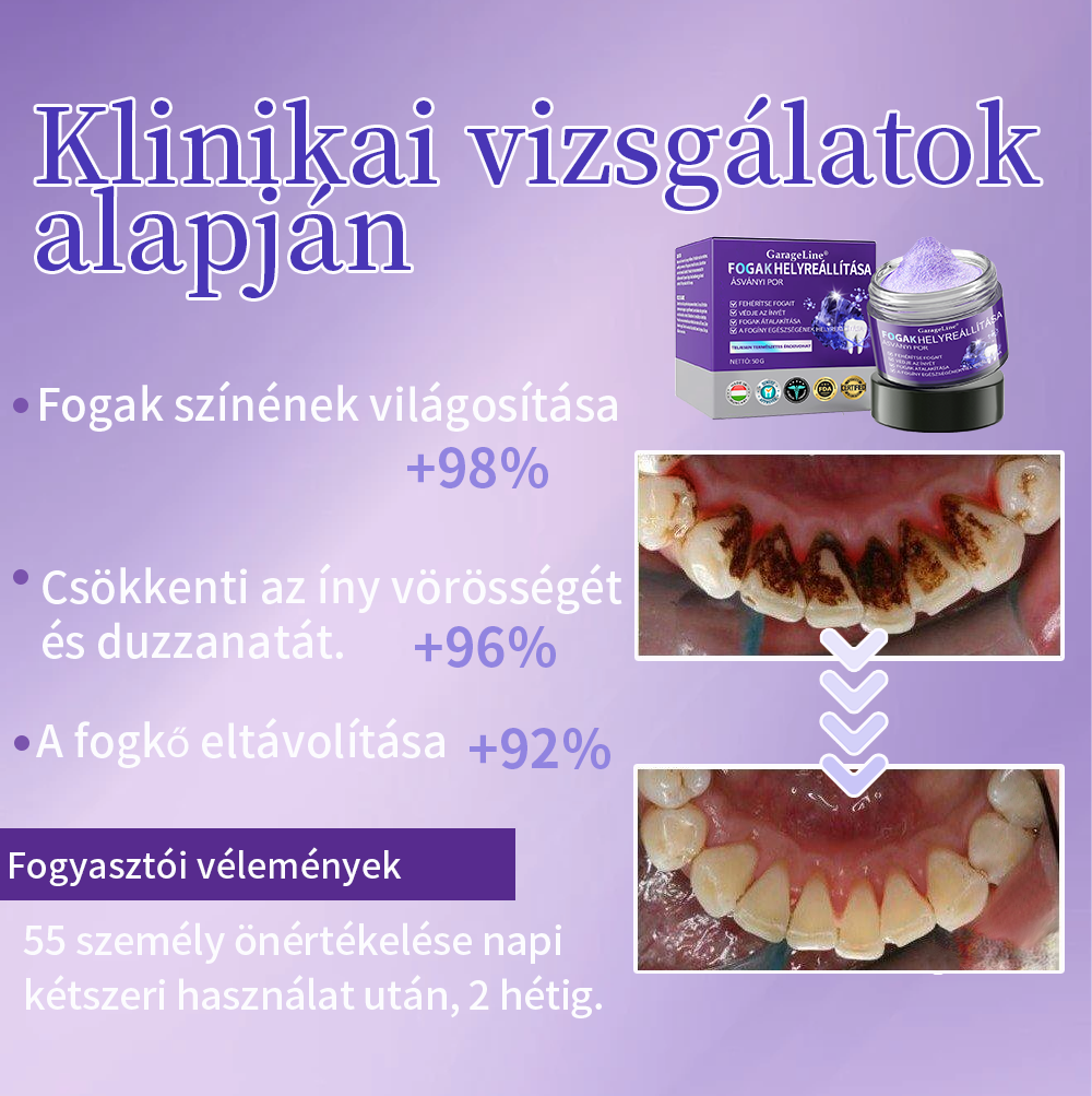 𝑮𝒂𝒓𝒂𝒈𝒆𝑳𝒊𝒏𝒆® 𝑭𝒐𝒈𝒉𝒆𝒍𝒚𝒓𝒆á𝒍𝒍í𝒕ó Á𝒔𝒗á𝒏𝒚𝒊 𝑷𝒐𝒓 🏪 (𝑨𝒍𝒌𝒂𝒍𝒎𝒂𝒔 𝒇𝒐𝒈𝒔𝒛𝒖𝒗𝒂𝒔𝒐𝒅á𝒔, 𝒇𝒐𝒈é𝒓𝒛é𝒌𝒆𝒏𝒚𝒔é𝒈, í𝒏𝒚𝒗𝒊𝒔𝒔𝒛𝒂𝒉ú𝒛ó𝒅á𝒔, 𝒔𝒛á𝒋ü𝒓𝒆𝒈𝒊 𝒈𝒚𝒖𝒍𝒍𝒂𝒅á𝒔, 𝒇𝒐𝒈á𝒈𝒚𝒃𝒆𝒕𝒆𝒈𝒔é𝒈𝒆𝒌 é𝒔 𝒌ü𝒍ö𝒏𝒃ö𝒛ő 𝒇𝒐𝒈á𝒔𝒛𝒂𝒕𝒊 é𝒔 𝒔𝒛á𝒋á𝒑𝒐𝒍á𝒔𝒊 𝒑𝒓𝒐𝒃𝒍é𝒎á𝒌 𝒆𝒔𝒆𝒕é𝒏.) 🌿🌿