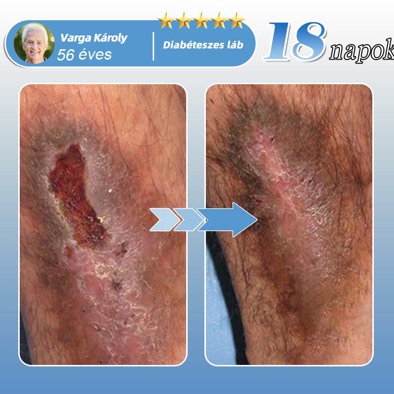 🇭🇺🌱✅𝐇𝐞𝐚𝐥𝐫𝐢𝐳𝐞® MoveFree Vital tapasz⚡Nyomelemek és gyógynövényes támogatás🌱Cukorbetegség, visszér, ízületi gyulladás, idegfájdalom