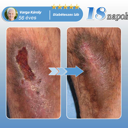 🇭🇺🌱✅𝐇𝐞𝐚𝐥𝐫𝐢𝐳𝐞® MoveFree Vital tapasz⚡Nyomelemek és gyógynövényes támogatás🌱Cukorbetegség, visszér, ízületi gyulladás, idegfájdalom