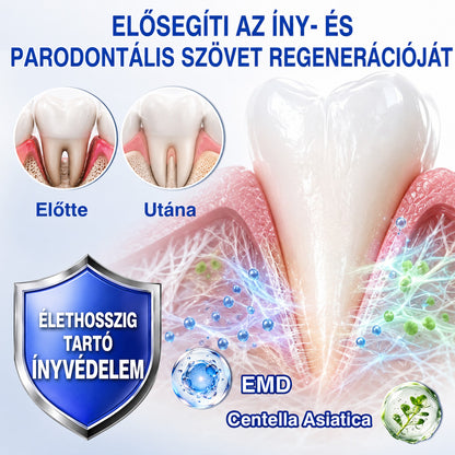 🇭🇺👨‍⚕️✅🦷 Trilumia® GumRevive – fejlett gél az íny és a fogágy ápolására