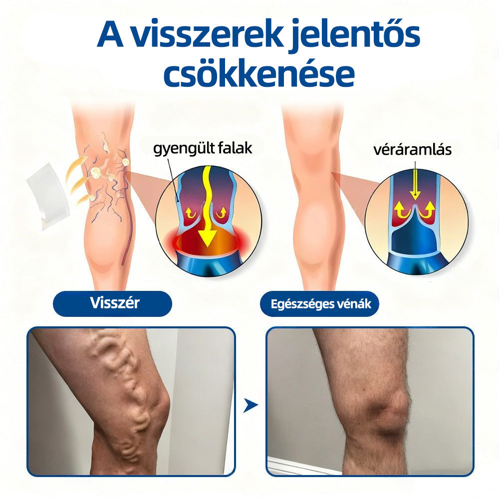 🇭🇺𝐇𝐞𝐚𝐥𝐫𝐢𝐳𝐞® ✅VeinTarget mikrotűs tapasz👩‍⚕️⚡Azonnali enyhülés hosszú távú eredmények