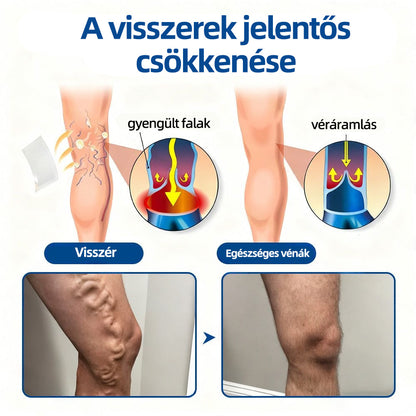 🇭🇺𝐇𝐞𝐚𝐥𝐫𝐢𝐳𝐞® ✅VeinTarget mikrotűs tapasz👩‍⚕️⚡Azonnali enyhülés hosszú távú eredmények