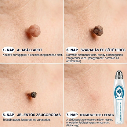 𝐇𝐢𝐯𝐚𝐭𝐚𝐥𝐨𝐬 𝐦á𝐫𝐤𝐚𝐛𝐨𝐥𝐭 | ✅ 𝐓𝐫𝐢𝐥𝐮𝐦𝐢𝐚® 𝟕 𝐧𝐚𝐩𝐨𝐬 𝐤é𝐬𝐳í𝐭𝐦é𝐧𝐲 𝐛ő𝐫𝐤𝐢𝐧ö𝐯é𝐬𝐞𝐤 é𝐬 𝐩𝐢𝐠𝐦𝐞𝐧𝐭𝐟𝐨𝐥𝐭𝐨𝐤 𝐞𝐥𝐭á𝐯𝐨𝐥í𝐭á𝐬á𝐫𝐚 (𝐟á𝐣𝐝𝐚𝐥𝐨𝐦𝐦𝐞𝐧𝐭𝐞𝐬, 𝐡𝐞𝐠 𝐧é𝐥𝐤ü𝐥𝐢 𝐫𝐨𝐥𝐥-𝐨𝐧 𝐚𝐩𝐩𝐥𝐢𝐤á𝐭𝐨𝐫)