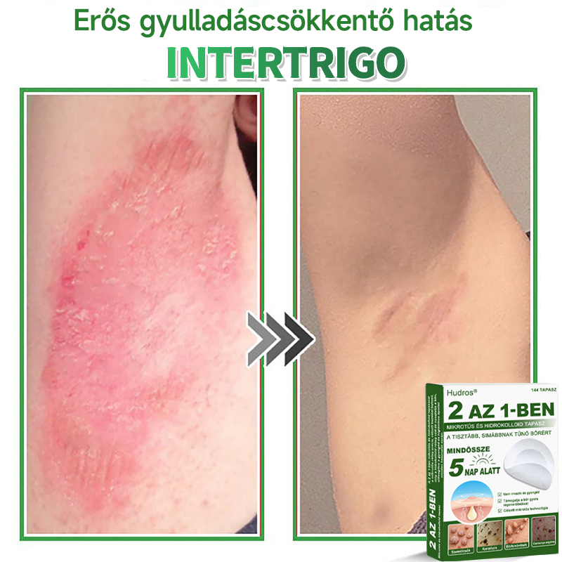 📌 𝐇𝐮𝐝𝐫𝐨𝐬® 𝟐 𝐚𝐳 𝟏-𝐛𝐞𝐧 𝐦𝐢𝐤𝐫𝐨𝐭ű𝐬 𝐡𝐢𝐝𝐫𝐨𝐤𝐨𝐥𝐥𝐨𝐢𝐝 𝐭𝐚𝐩𝐚𝐬𝐳𝐨𝐤 | 𝐊𝐢𝐞𝐦𝐞𝐥𝐤𝐞𝐝ő 𝐚𝐧𝐲𝐚𝐣𝐞𝐠𝐲𝐞𝐤, 𝐩𝐚𝐭𝐭𝐚𝐧á𝐬𝐨𝐤, 𝐥𝐚𝐩𝐨𝐬 𝐬𝐳𝐞𝐦ö𝐥𝐜𝐬ö𝐤 é𝐬 𝐛ő𝐫𝐤𝐢𝐧ö𝐯é𝐬𝐞𝐤 𝐞𝐥𝐭á𝐯𝐨𝐥í𝐭á𝐬á𝐫𝐚 𝐬𝐩𝐞𝐜𝐢𝐚𝐥𝐢𝐳á𝐥𝐯𝐚 | 𝐋á𝐭𝐡𝐚𝐭𝐚𝐭𝐥𝐚𝐧, 𝐜𝐬𝐢𝐥𝐥𝐚𝐠 𝐚𝐥𝐚𝐤ú 𝐩𝐚𝐭𝐭𝐚𝐧á𝐬𝐭𝐚𝐩𝐚𝐬𝐳𝐨𝐤 (𝐚𝐫𝐜𝐫𝐚 é𝐬 𝐭𝐞𝐬𝐭𝐫𝐞) | 𝟏𝟒𝟒 𝐝𝐚𝐫𝐚𝐛𝐨𝐬 𝐜𝐬𝐨𝐦𝐚𝐠🌱