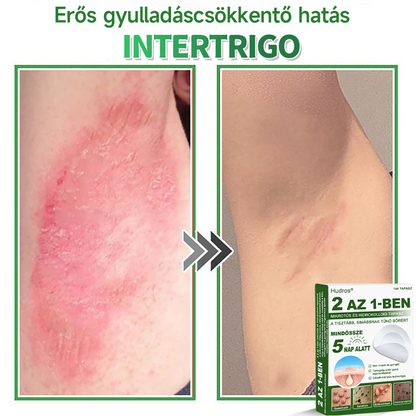 📌 𝐇𝐮𝐝𝐫𝐨𝐬® 𝟐 𝐚𝐳 𝟏-𝐛𝐞𝐧 𝐦𝐢𝐤𝐫𝐨𝐭ű𝐬 𝐡𝐢𝐝𝐫𝐨𝐤𝐨𝐥𝐥𝐨𝐢𝐝 𝐭𝐚𝐩𝐚𝐬𝐳𝐨𝐤 | 𝐊𝐢𝐞𝐦𝐞𝐥𝐤𝐞𝐝ő 𝐚𝐧𝐲𝐚𝐣𝐞𝐠𝐲𝐞𝐤, 𝐩𝐚𝐭𝐭𝐚𝐧á𝐬𝐨𝐤, 𝐥𝐚𝐩𝐨𝐬 𝐬𝐳𝐞𝐦ö𝐥𝐜𝐬ö𝐤 é𝐬 𝐛ő𝐫𝐤𝐢𝐧ö𝐯é𝐬𝐞𝐤 𝐞𝐥𝐭á𝐯𝐨𝐥í𝐭á𝐬á𝐫𝐚 𝐬𝐩𝐞𝐜𝐢𝐚𝐥𝐢𝐳á𝐥𝐯𝐚 | 𝐋á𝐭𝐡𝐚𝐭𝐚𝐭𝐥𝐚𝐧, 𝐜𝐬𝐢𝐥𝐥𝐚𝐠 𝐚𝐥𝐚𝐤ú 𝐩𝐚𝐭𝐭𝐚𝐧á𝐬𝐭𝐚𝐩𝐚𝐬𝐳𝐨𝐤 (𝐚𝐫𝐜𝐫𝐚 é𝐬 𝐭𝐞𝐬𝐭𝐫𝐞) | 𝟏𝟒𝟒 𝐝𝐚𝐫𝐚𝐛𝐨𝐬 𝐜𝐬𝐨𝐦𝐚𝐠🌱