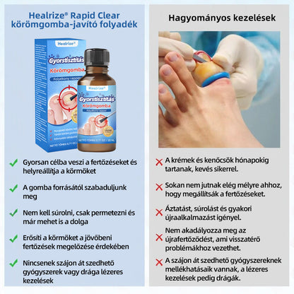 𝑯𝒆𝒂𝒍𝒓𝒊𝒛𝒆® 𝑵𝒂𝒏𝒐 𝑮𝒚𝒐𝒓𝒔 𝑯𝒂𝒕á𝒔ú 𝑻𝒊𝒔𝒛𝒕í𝒕ó 𝑲ö𝒓ö𝒎𝒈𝒐𝒎𝒃𝒂 𝑬𝒍𝒍𝒆𝒏𝒊 𝑱𝒂𝒗í𝒕ó 𝑭𝒐𝒍𝒚𝒂𝒅é𝒌 🧑‍⚕️ | 𝑯𝒂𝒕é𝒌𝒐𝒏𝒚 7 𝒏𝒂𝒑 𝒂𝒍𝒂𝒕𝒕, 𝒕𝒂𝒓𝒕ó𝒔𝒂𝒏 𝒎𝒆𝒈𝒔𝒛ü𝒏𝒕𝒆𝒕𝒊 𝒂 𝒌𝒊𝒗á𝒍𝒕ó 𝒐𝒌𝒐𝒕 🥥