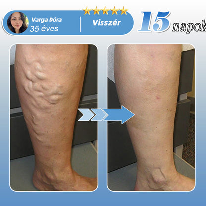 🇭🇺🌱✅𝐇𝐞𝐚𝐥𝐫𝐢𝐳𝐞® MoveFree Vital tapasz⚡Nyomelemek és gyógynövényes támogatás🌱Cukorbetegség, visszér, ízületi gyulladás, idegfájdalom