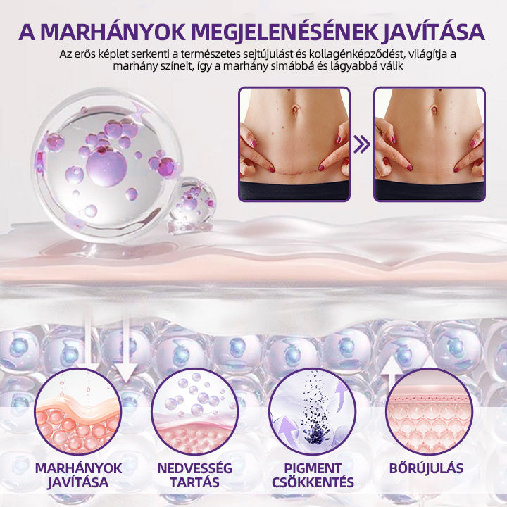 IEY® ReGenScar őssejt-heggyel kezel👨‍⚕️Keloid hegek, akne hegek, bárányhimlő hegek, műtéti hegek, égési hegek