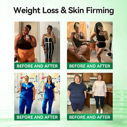 𝐏𝐡𝐲𝐬𝐢𝐜𝐢𝐚𝐧-𝐅𝐨𝐫𝐦𝐮𝐥𝐚𝐭𝐞𝐝🌱 | 𝐌𝐑𝐄𝐕𝐁𝑺𝑰𝑵® 𝐁𝐞𝐫𝐛𝐞𝐫𝐢𝐧𝐞 × 𝐍𝐀𝐃+ 𝟏𝟎-𝐢𝐧-𝟏 𝐀𝐝𝐯𝐚𝐧𝐜𝐞𝐝 𝐓𝐡𝐞𝐫𝐦𝐨-𝐀𝐜𝐭𝐢𝐯𝐞 𝐁𝐨𝐝𝐲 𝐂𝐨𝐧𝐭𝐨𝐮𝐫 𝐒𝐥𝐢𝐦𝐦𝐢𝐧𝐠 𝐒𝐭𝐢𝐜𝐤 (𝐅𝐨𝐫 𝐚 𝐅𝐢𝐫𝐦𝐞𝐫, 𝐒𝐦𝐨𝐨𝐭𝐡𝐞𝐫 & 𝐌𝐨𝐫𝐞 𝐃𝐞𝐟𝐢𝐧𝐞𝐝-𝐋𝐨𝐨𝐤𝐢𝐧𝐠 𝐁𝐨𝐝𝐲)