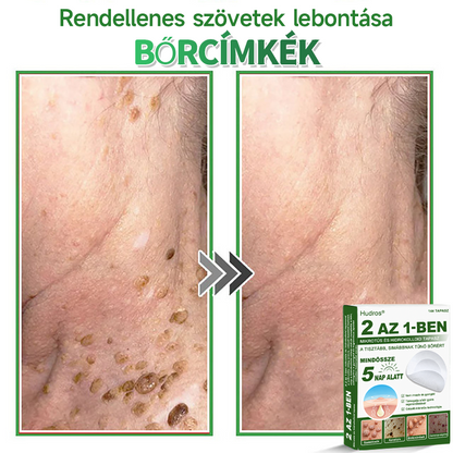 📌 𝐇𝐮𝐝𝐫𝐨𝐬® 𝟐 𝐚𝐳 𝟏-𝐛𝐞𝐧 𝐦𝐢𝐤𝐫𝐨𝐭ű𝐬 𝐡𝐢𝐝𝐫𝐨𝐤𝐨𝐥𝐥𝐨𝐢𝐝 𝐭𝐚𝐩𝐚𝐬𝐳𝐨𝐤 | 𝐊𝐢𝐞𝐦𝐞𝐥𝐤𝐞𝐝ő 𝐚𝐧𝐲𝐚𝐣𝐞𝐠𝐲𝐞𝐤, 𝐩𝐚𝐭𝐭𝐚𝐧á𝐬𝐨𝐤, 𝐥𝐚𝐩𝐨𝐬 𝐬𝐳𝐞𝐦ö𝐥𝐜𝐬ö𝐤 é𝐬 𝐛ő𝐫𝐤𝐢𝐧ö𝐯é𝐬𝐞𝐤 𝐞𝐥𝐭á𝐯𝐨𝐥í𝐭á𝐬á𝐫𝐚 𝐬𝐩𝐞𝐜𝐢𝐚𝐥𝐢𝐳á𝐥𝐯𝐚 | 𝐋á𝐭𝐡𝐚𝐭𝐚𝐭𝐥𝐚𝐧, 𝐜𝐬𝐢𝐥𝐥𝐚𝐠 𝐚𝐥𝐚𝐤ú 𝐩𝐚𝐭𝐭𝐚𝐧á𝐬𝐭𝐚𝐩𝐚𝐬𝐳𝐨𝐤 (𝐚𝐫𝐜𝐫𝐚 é𝐬 𝐭𝐞𝐬𝐭𝐫𝐞) | 𝟏𝟒𝟒 𝐝𝐚𝐫𝐚𝐛𝐨𝐬 𝐜𝐬𝐨𝐦𝐚𝐠🌱