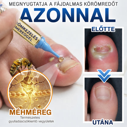🇭🇺 𝐓𝐫𝐢𝐥𝐮𝐦𝐢𝐚® 𝐅𝐮𝐧𝐠𝐢 𝐅𝐫𝐞𝐞 𝐦é𝐡𝐦é𝐫𝐠𝐞𝐬 𝐤ö𝐫ö𝐦𝐤𝐞𝐳𝐞𝐥é𝐬 🥼 – 𝐡é𝐭 𝐧𝐚𝐩𝐨𝐧 𝐛𝐞𝐥ü𝐥 𝐚𝐳𝐨𝐧𝐧𝐚𝐥𝐢 𝐥á𝐭𝐡𝐚𝐭ó 𝐞𝐫𝐞𝐝𝐦é𝐧𝐲é𝐫𝐭