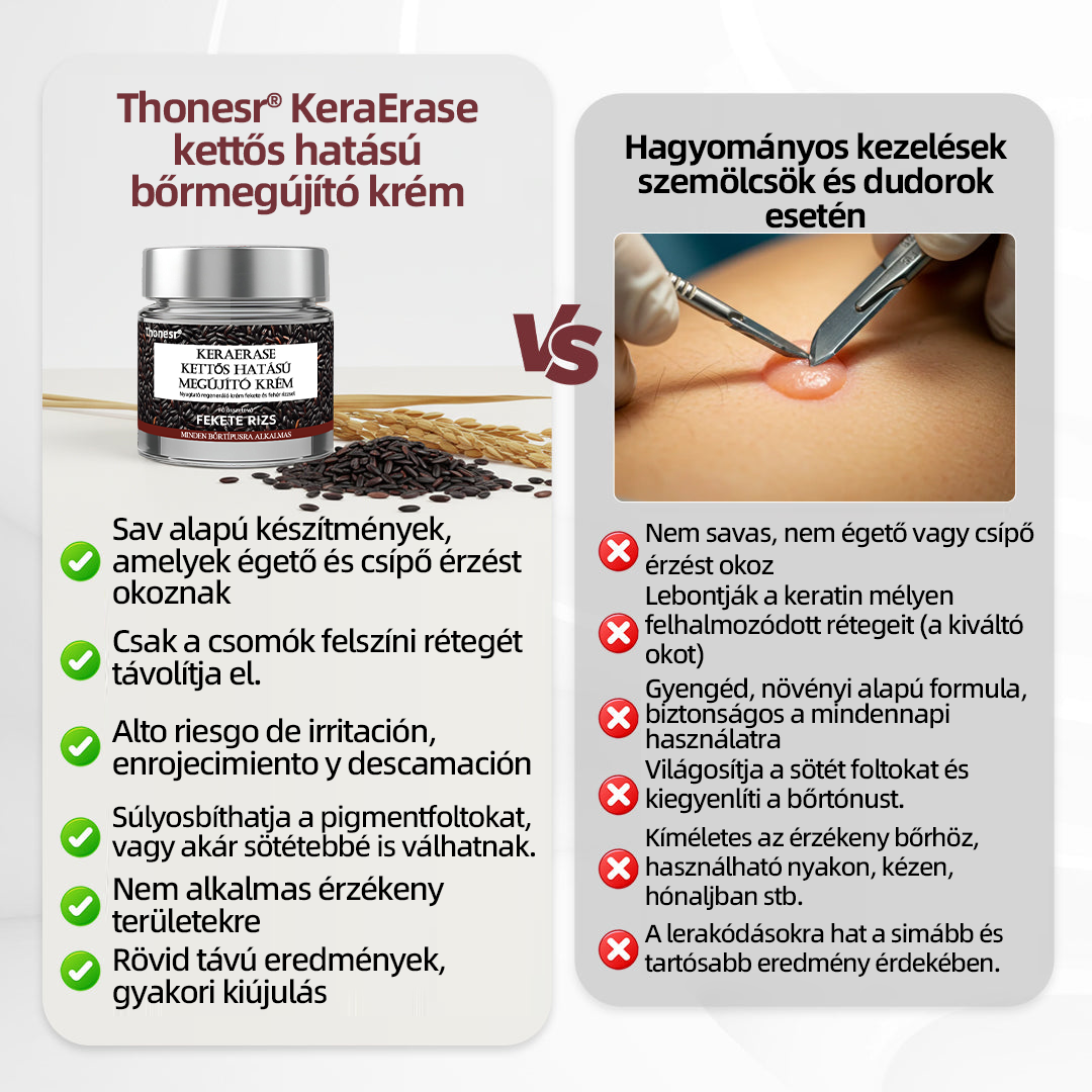 Thonesr® 👩‍⚕️KeraErase kettős hatású megújító krém