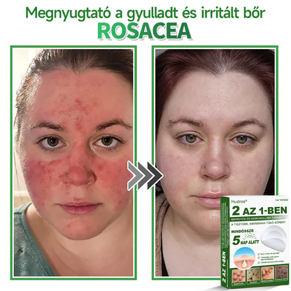 📌 𝐇𝐮𝐝𝐫𝐨𝐬® 𝟐 𝐚𝐳 𝟏-𝐛𝐞𝐧 𝐦𝐢𝐤𝐫𝐨𝐭ű𝐬 𝐡𝐢𝐝𝐫𝐨𝐤𝐨𝐥𝐥𝐨𝐢𝐝 𝐭𝐚𝐩𝐚𝐬𝐳𝐨𝐤 | 𝐊𝐢𝐞𝐦𝐞𝐥𝐤𝐞𝐝ő 𝐚𝐧𝐲𝐚𝐣𝐞𝐠𝐲𝐞𝐤, 𝐩𝐚𝐭𝐭𝐚𝐧á𝐬𝐨𝐤, 𝐥𝐚𝐩𝐨𝐬 𝐬𝐳𝐞𝐦ö𝐥𝐜𝐬ö𝐤 é𝐬 𝐛ő𝐫𝐤𝐢𝐧ö𝐯é𝐬𝐞𝐤 𝐞𝐥𝐭á𝐯𝐨𝐥í𝐭á𝐬á𝐫𝐚 𝐬𝐩𝐞𝐜𝐢𝐚𝐥𝐢𝐳á𝐥𝐯𝐚 | 𝐋á𝐭𝐡𝐚𝐭𝐚𝐭𝐥𝐚𝐧, 𝐜𝐬𝐢𝐥𝐥𝐚𝐠 𝐚𝐥𝐚𝐤ú 𝐩𝐚𝐭𝐭𝐚𝐧á𝐬𝐭𝐚𝐩𝐚𝐬𝐳𝐨𝐤 (𝐚𝐫𝐜𝐫𝐚 é𝐬 𝐭𝐞𝐬𝐭𝐫𝐞) | 𝟏𝟒𝟒 𝐝𝐚𝐫𝐚𝐛𝐨𝐬 𝐜𝐬𝐨𝐦𝐚𝐠🌱