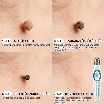 🥑🧊𝐇𝐢𝐯𝐚𝐭𝐚𝐥𝐨𝐬 𝐦á𝐫𝐤𝐚𝐛𝐨𝐥𝐭 | ✅ 𝐓𝐫𝐢𝐥𝐮𝐦𝐢𝐚® 𝟕 𝐧𝐚𝐩𝐨𝐬 𝐤é𝐬𝐳í𝐭𝐦é𝐧𝐲 𝐛ő𝐫𝐤𝐢𝐧ö𝐯=é𝐬𝐞𝐤 é𝐬 𝐩𝐢𝐠𝐦𝐞𝐧𝐭𝐟𝐨𝐥𝐭𝐨𝐤 𝐞𝐥𝐭á𝐯𝐨𝐥í𝐭á𝐬á𝐫𝐚 (𝐟á𝐣𝐝𝐚𝐥𝐨𝐦𝐦𝐞𝐧𝐭𝐞𝐬, 𝐡𝐞𝐠 𝐧é𝐥𝐤ü𝐥𝐢 𝐫𝐨𝐥𝐥-𝐨𝐧 𝐚𝐩𝐩𝐥𝐢𝐤á𝐭𝐨𝐫)
