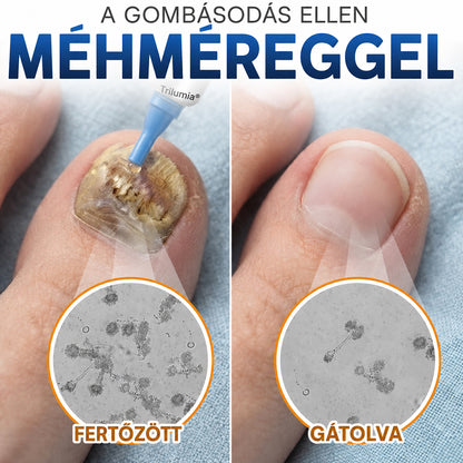 🇭🇺 𝐓𝐫𝐢𝐥𝐮𝐦𝐢𝐚® 𝐅𝐮𝐧𝐠𝐢 𝐅𝐫𝐞𝐞 𝐦é𝐡𝐦é𝐫𝐠𝐞𝐬 𝐤ö𝐫ö𝐦𝐤𝐞𝐳𝐞𝐥é𝐬 🥼 – 𝐡é𝐭 𝐧𝐚𝐩𝐨𝐧 𝐛𝐞𝐥ü𝐥 𝐚𝐳𝐨𝐧𝐧𝐚𝐥𝐢 𝐥á𝐭𝐡𝐚𝐭ó 𝐞𝐫𝐞𝐝𝐦é𝐧𝐲é𝐫𝐭