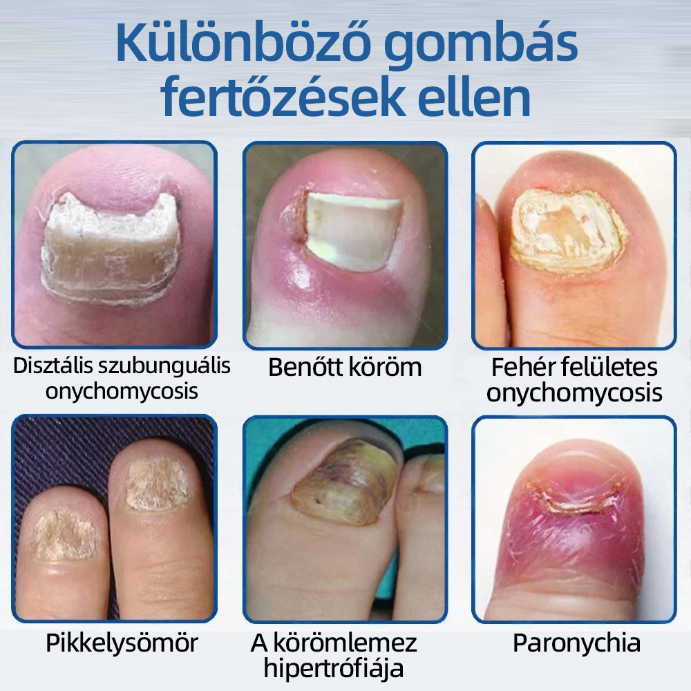 𝑯𝒆𝒂𝒍𝒓𝒊𝒛𝒆® 𝑵𝒂𝒏𝒐 𝑮𝒚𝒐𝒓𝒔 𝑯𝒂𝒕á𝒔ú 𝑻𝒊𝒔𝒛𝒕í𝒕ó 𝑲ö𝒓ö𝒎𝒈𝒐𝒎𝒃𝒂 𝑬𝒍𝒍𝒆𝒏𝒊 𝑱𝒂𝒗í𝒕ó 𝑭𝒐𝒍𝒚𝒂𝒅é𝒌 🧑‍⚕️ | 𝑯𝒂𝒕é𝒌𝒐𝒏𝒚 7 𝒏𝒂𝒑 𝒂𝒍𝒂𝒕𝒕, 𝒕𝒂𝒓𝒕ó𝒔𝒂𝒏 𝒎𝒆𝒈𝒔𝒛ü𝒏𝒕𝒆𝒕𝒊 𝒂 𝒌𝒊𝒗á𝒍𝒕ó 𝒐𝒌𝒐𝒕 🥥