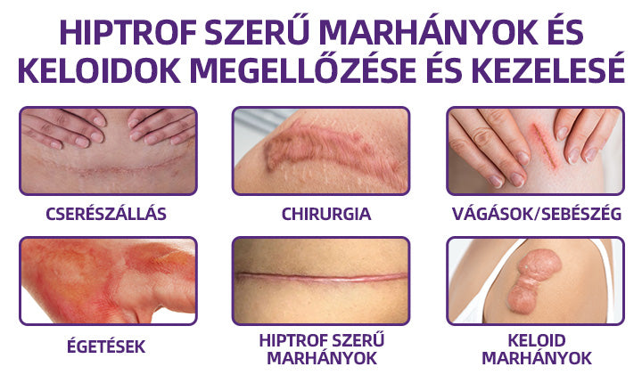 IEY® ReGenScar őssejt-heggyel kezel👨‍⚕️Keloid hegek, akne hegek, bárányhimlő hegek, műtéti hegek, égési hegek