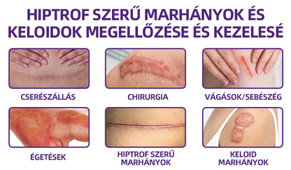 IEY® ReGenScar őssejt-heggyel kezel👨‍⚕️Keloid hegek, akne hegek, bárányhimlő hegek, műtéti hegek, égési hegek