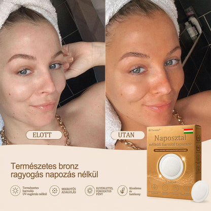 𝐇𝐢𝐯𝐚𝐭𝐚𝐥𝐨𝐬 𝐦á𝐫𝐤𝐚ü𝐳𝐥𝐞𝐭 | ☀️ 𝐓𝐮𝐫𝐨𝐧𝐮® 𝐍𝐚𝐩𝐟é𝐧𝐲 𝐧é𝐥𝐤ü𝐥𝐢 𝐭𝐫𝐚𝐧𝐬𝐳𝐝𝐞𝐫𝐦á𝐥𝐢𝐬 𝐛𝐚𝐫𝐧í𝐭ó 𝐭𝐚𝐩𝐚𝐬𝐳 👨‍⚕️ — É𝐛𝐫𝐞𝐬𝐳𝐝 𝐟𝐞𝐥 𝐭𝐞𝐫𝐦é𝐬𝐳𝐞𝐭𝐞𝐬 𝐛𝐫𝐨𝐧𝐳𝐨𝐬 𝐫𝐚𝐠𝐲𝐨𝐠á𝐬𝐨𝐝𝐚𝐭🛒