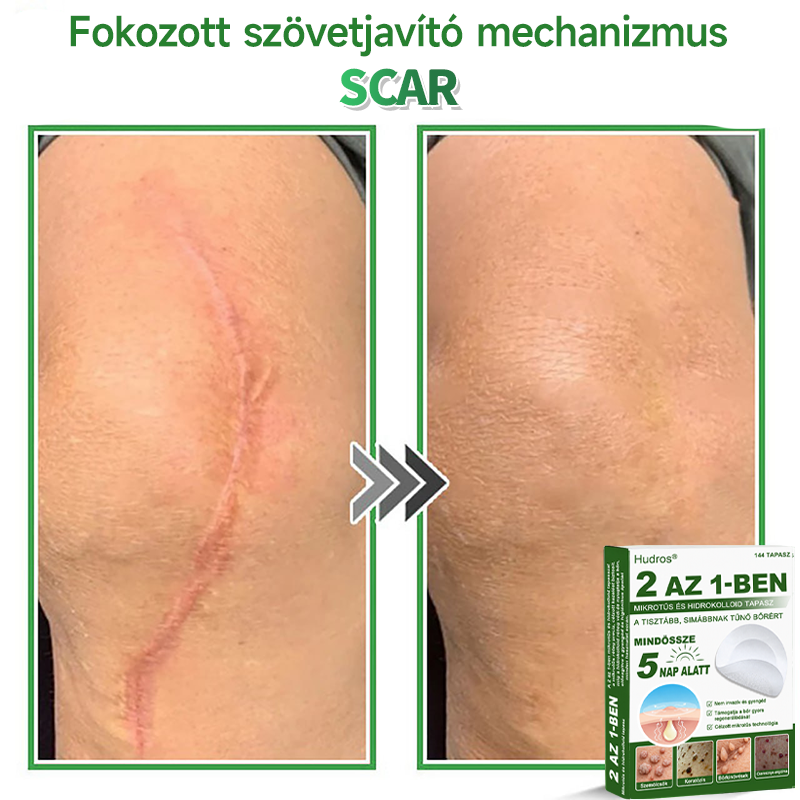 📌 𝐇𝐮𝐝𝐫𝐨𝐬® 𝟐 𝐚𝐳 𝟏-𝐛𝐞𝐧 𝐦𝐢𝐤𝐫𝐨𝐭ű𝐬 𝐡𝐢𝐝𝐫𝐨𝐤𝐨𝐥𝐥𝐨𝐢𝐝 𝐭𝐚𝐩𝐚𝐬𝐳𝐨𝐤 | 𝐊𝐢𝐞𝐦𝐞𝐥𝐤𝐞𝐝ő 𝐚𝐧𝐲𝐚𝐣𝐞𝐠𝐲𝐞𝐤, 𝐩𝐚𝐭𝐭𝐚𝐧á𝐬𝐨𝐤, 𝐥𝐚𝐩𝐨𝐬 𝐬𝐳𝐞𝐦ö𝐥𝐜𝐬ö𝐤 é𝐬 𝐛ő𝐫𝐤𝐢𝐧ö𝐯é𝐬𝐞𝐤 𝐞𝐥𝐭á𝐯𝐨𝐥í𝐭á𝐬á𝐫𝐚 𝐬𝐩𝐞𝐜𝐢𝐚𝐥𝐢𝐳á𝐥𝐯𝐚 | 𝐋á𝐭𝐡𝐚𝐭𝐚𝐭𝐥𝐚𝐧, 𝐜𝐬𝐢𝐥𝐥𝐚𝐠 𝐚𝐥𝐚𝐤ú 𝐩𝐚𝐭𝐭𝐚𝐧á𝐬𝐭𝐚𝐩𝐚𝐬𝐳𝐨𝐤 (𝐚𝐫𝐜𝐫𝐚 é𝐬 𝐭𝐞𝐬𝐭𝐫𝐞) | 𝟏𝟒𝟒 𝐝𝐚𝐫𝐚𝐛𝐨𝐬 𝐜𝐬𝐨𝐦𝐚𝐠🌱