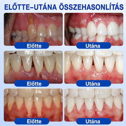 🇭🇺👨‍⚕️✅🦷 Trilumia® GumRevive – fejlett gél az íny és a fogágy ápolására