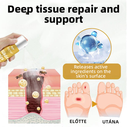 🔥Hivatalos áruház | DOCTIA® GlucoShield méhcsípés elleni sebspray