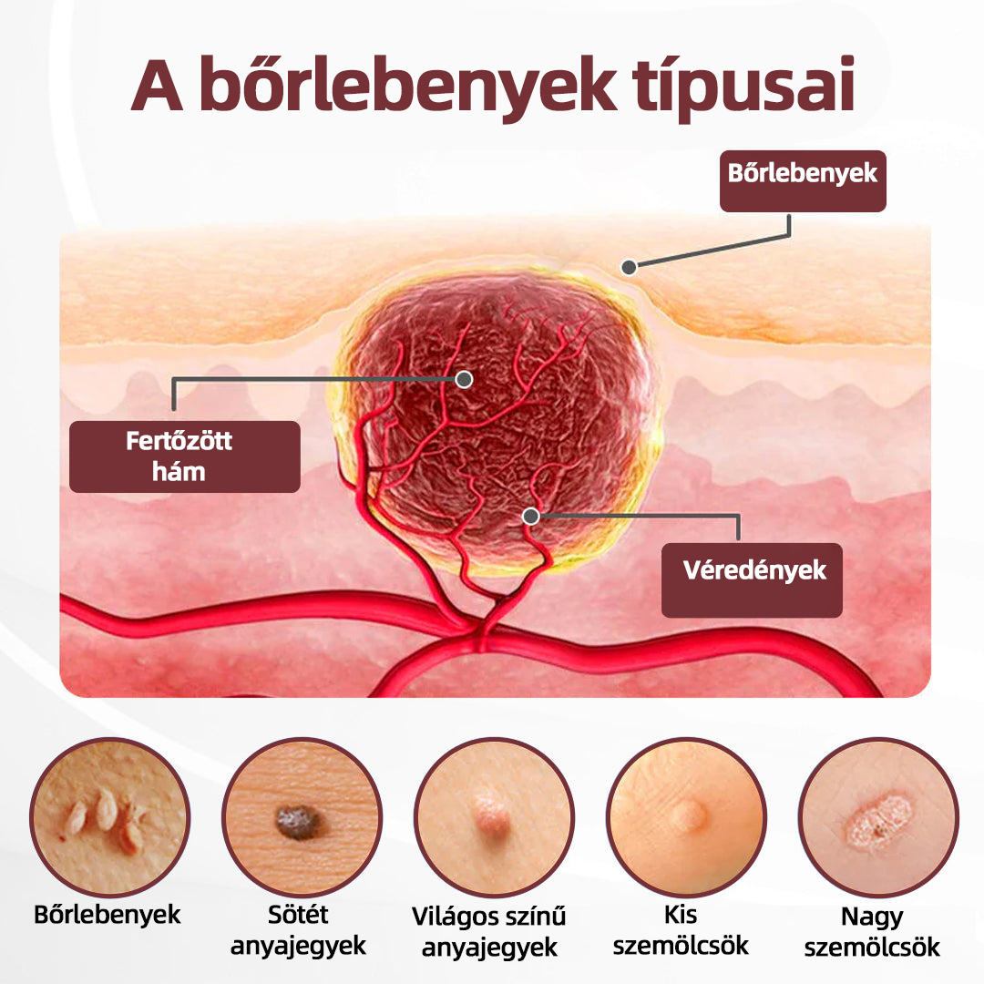 Thonesr® 👩‍⚕️KeraErase kettős hatású megújító krém