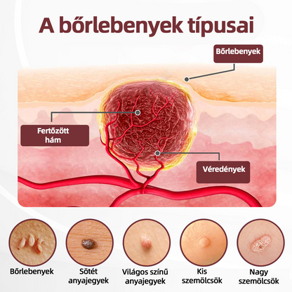 Thonesr® 👩‍⚕️KeraErase kettős hatású megújító krém