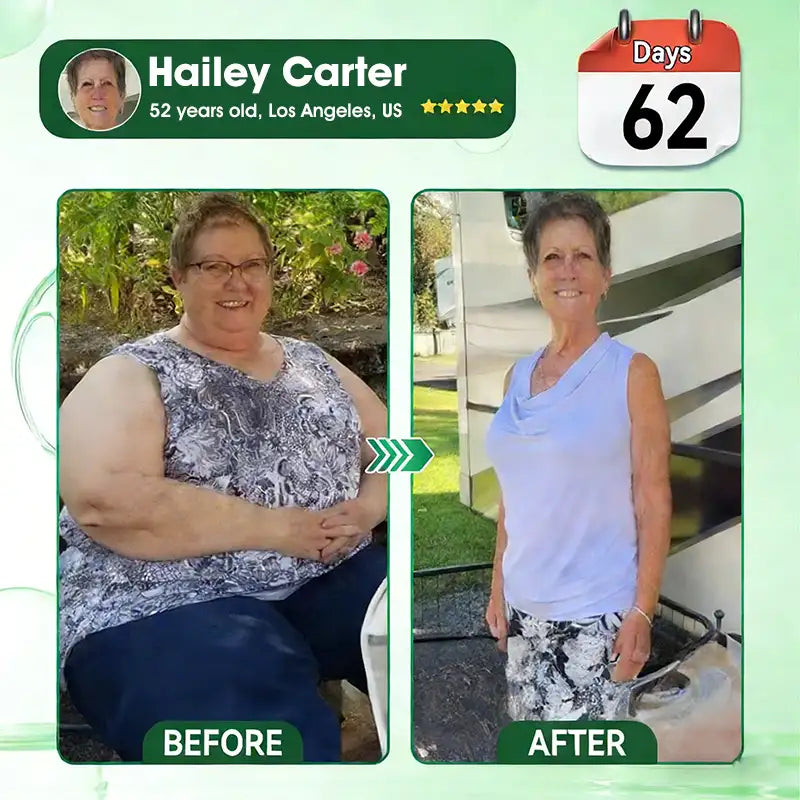 𝐏𝐡𝐲𝐬𝐢𝐜𝐢𝐚𝐧-𝐅𝐨𝐫𝐦𝐮𝐥𝐚𝐭𝐞𝐝🌱 | 𝐌𝐑𝐄𝐕𝐁𝑺𝑰𝑵® 𝐁𝐞𝐫𝐛𝐞𝐫𝐢𝐧𝐞 × 𝐍𝐀𝐃+ 𝟏𝟎-𝐢𝐧-𝟏 𝐀𝐝𝐯𝐚𝐧𝐜𝐞𝐝 𝐓𝐡𝐞𝐫𝐦𝐨-𝐀𝐜𝐭𝐢𝐯𝐞 𝐁𝐨𝐝𝐲 𝐂𝐨𝐧𝐭𝐨𝐮𝐫 𝐒𝐥𝐢𝐦𝐦𝐢𝐧𝐠 𝐒𝐭𝐢𝐜𝐤 (𝐅𝐨𝐫 𝐚 𝐅𝐢𝐫𝐦𝐞𝐫, 𝐒𝐦𝐨𝐨𝐭𝐡𝐞𝐫 & 𝐌𝐨𝐫𝐞 𝐃𝐞𝐟𝐢𝐧𝐞𝐝-𝐋𝐨𝐨𝐤𝐢𝐧𝐠 𝐁𝐨𝐝𝐲)