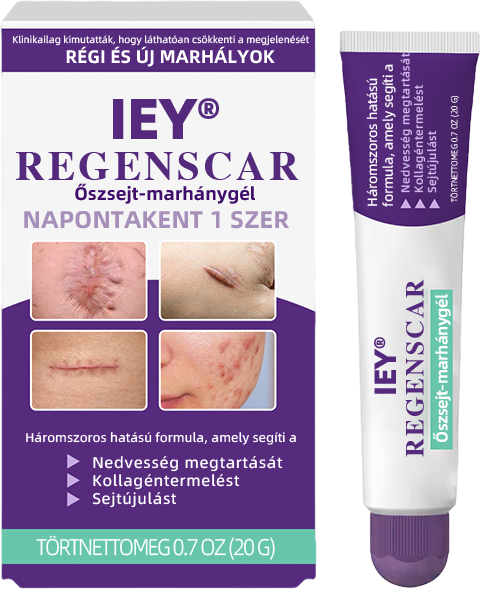 IEY® ReGenScar őssejt-heggyel kezel👨‍⚕️Keloid hegek, akne hegek, bárányhimlő hegek, műtéti hegek, égési hegek