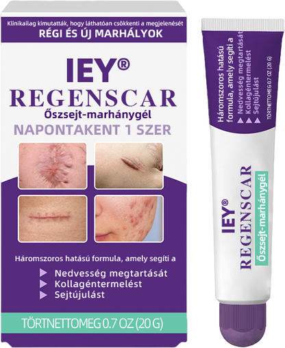 IEY® ReGenScar őssejt-heggyel kezel👨‍⚕️Keloid hegek, akne hegek, bárányhimlő hegek, műtéti hegek, égési hegek